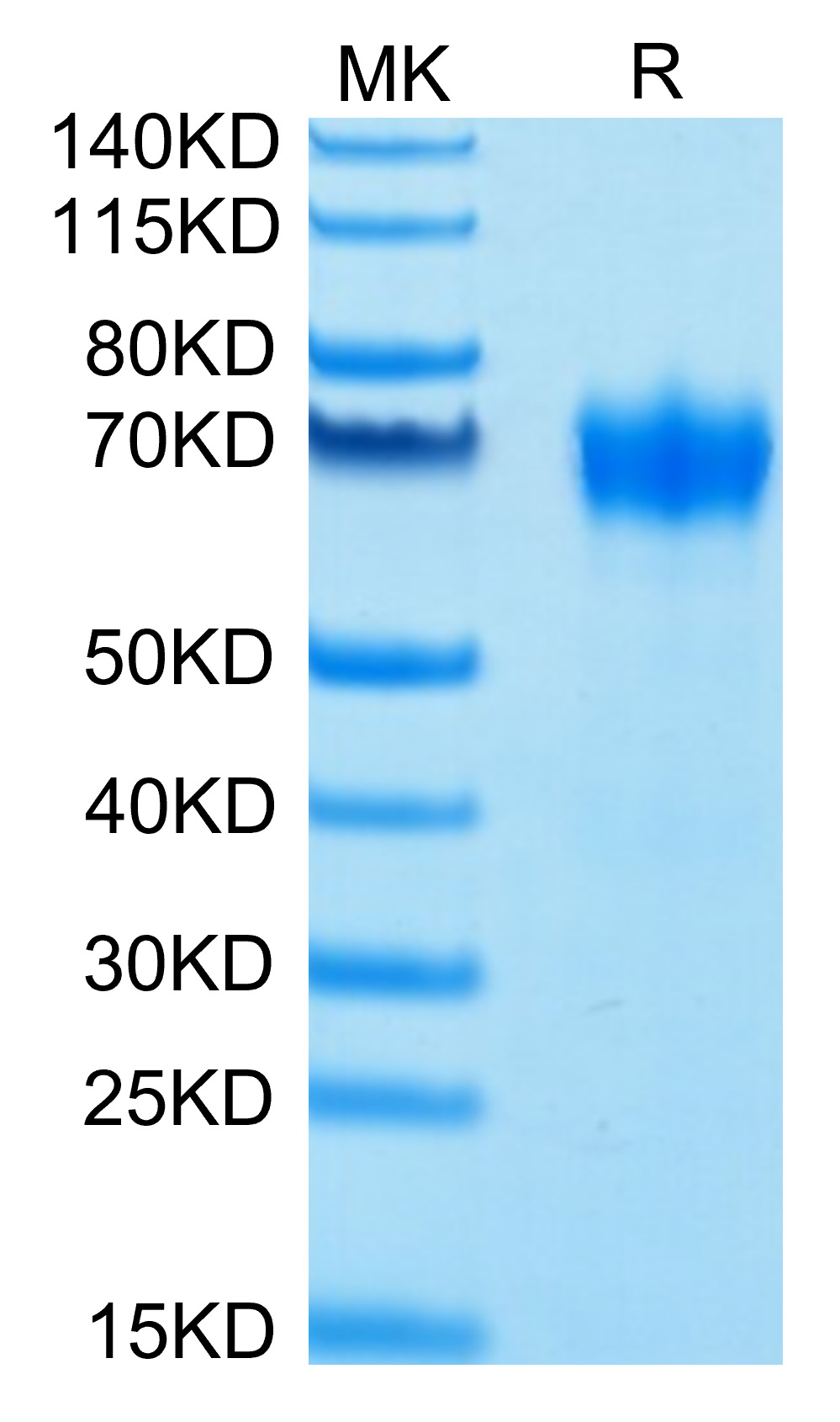 Biotinylated Recombinant Human CSF2RA/GM-CSF R alpha/CD116 Protein