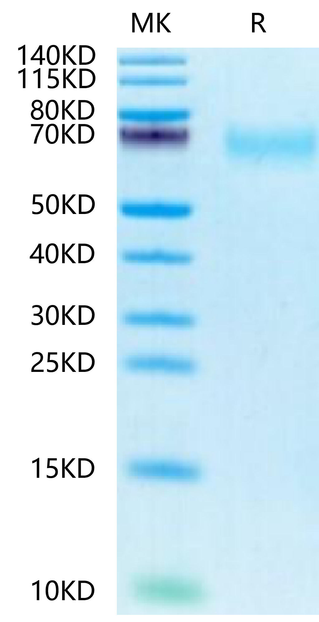 Biotinylated Recombinant Human CEACAM8/CD66b Protein