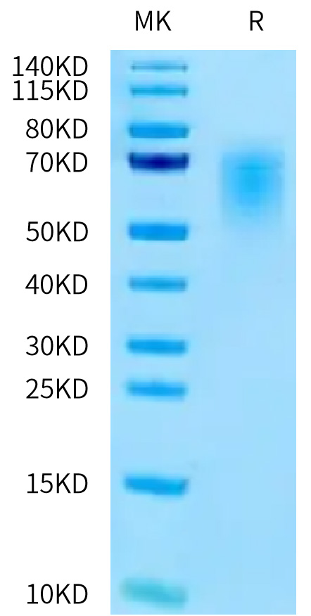 Recombinant Human CEACAM5/CEA/CD66e (145-322) Protein