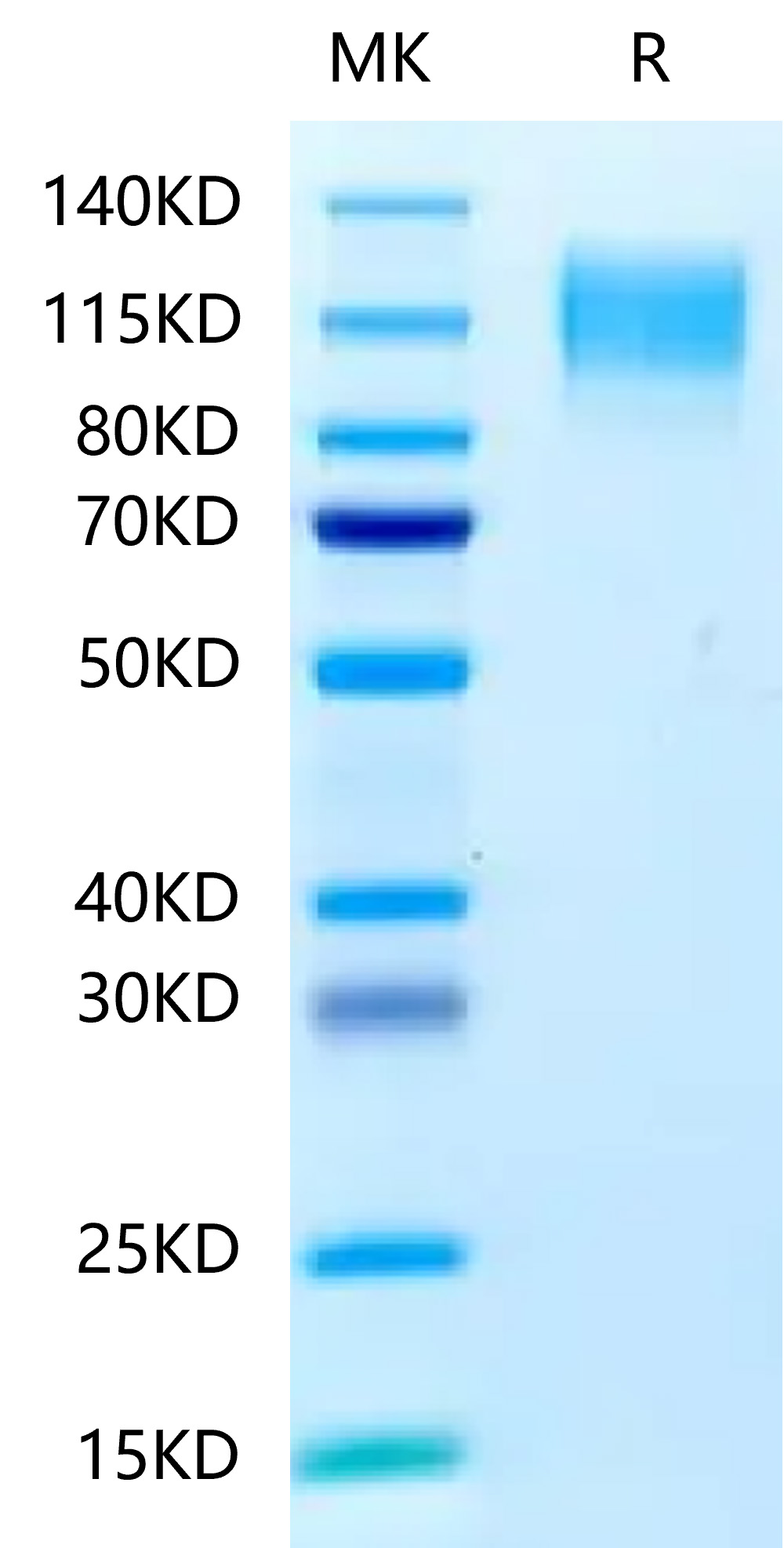 Recombinant Human CEACAM5/CEA/CD66e Protein