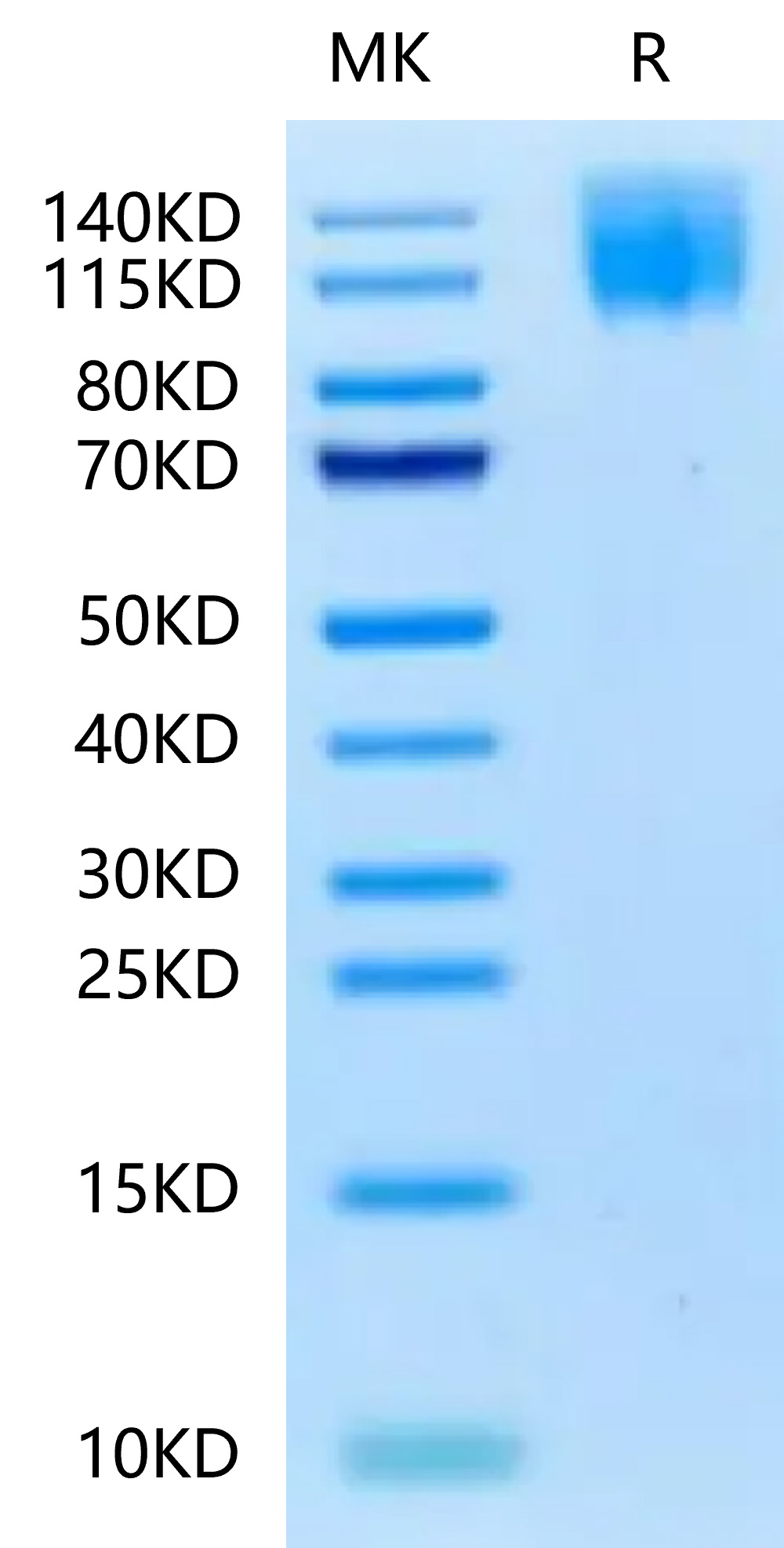 Biotinylated Recombinant Human CEACAM5/CEA/CD66e Protein