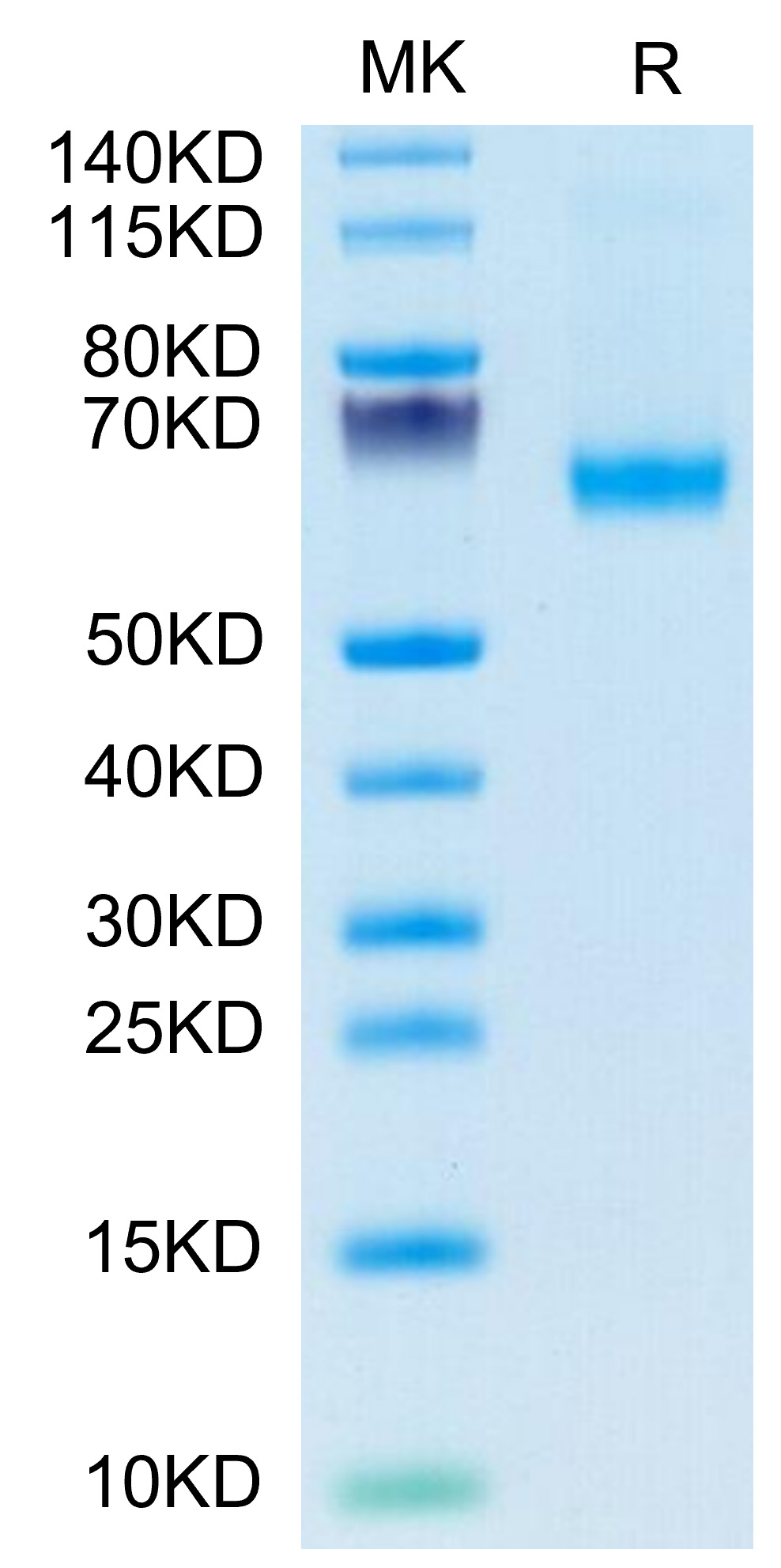 FITC-Labeled Recombinant Human TNFSF7/CD27 Ligand/CD70  Trimer Protein