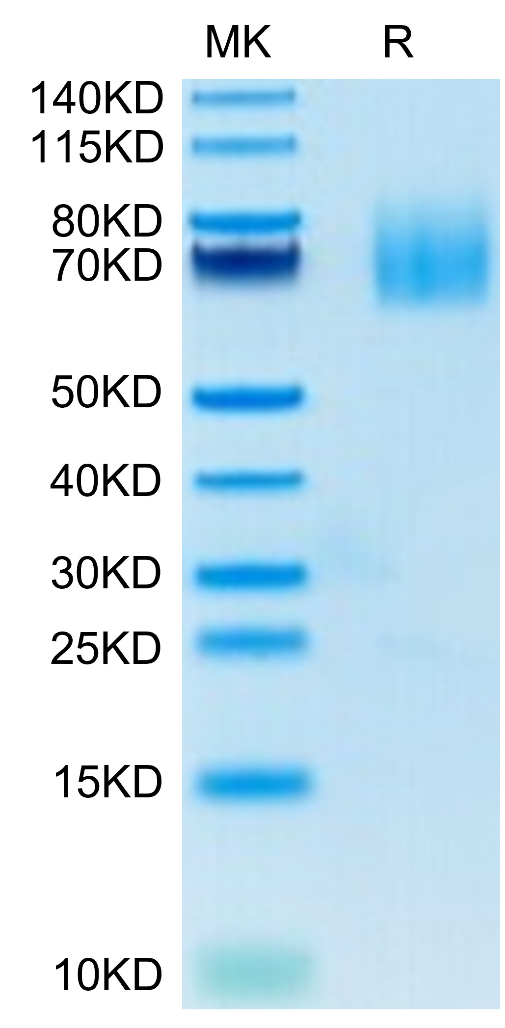 Recombinant Human TNFSF7/CD27 Ligand/CD70 Protein