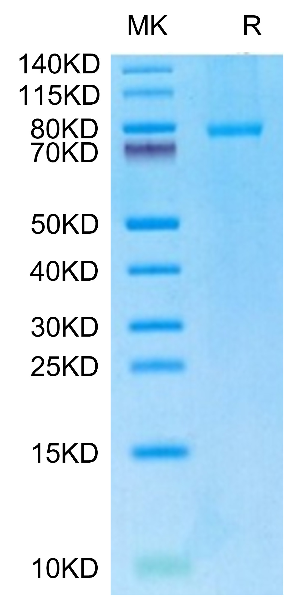 Recombinant Human TNFSF5/CD40 Ligand/CD154 Trimer Protein