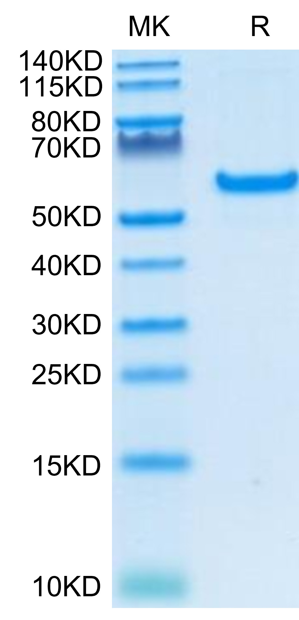 Recombinant Human TNFRSF5/CD40 Protein