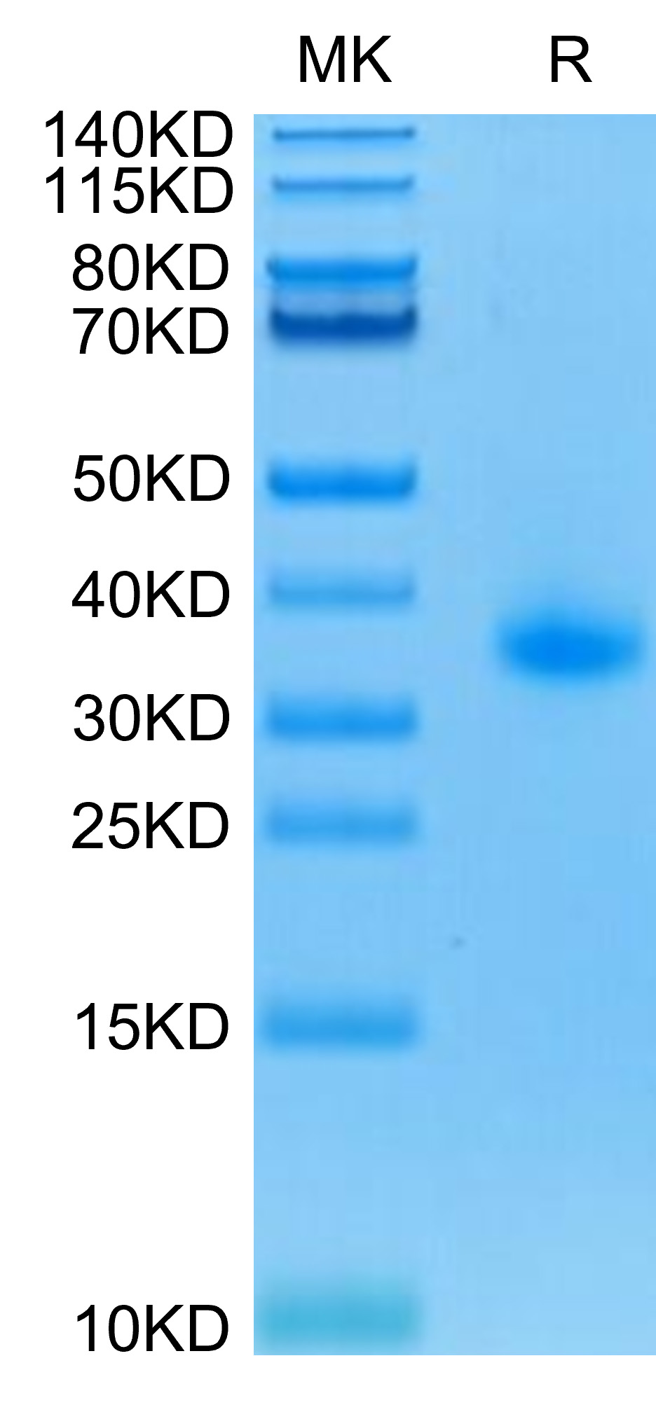 Recombinant Human TNFRSF5/CD40 Protein