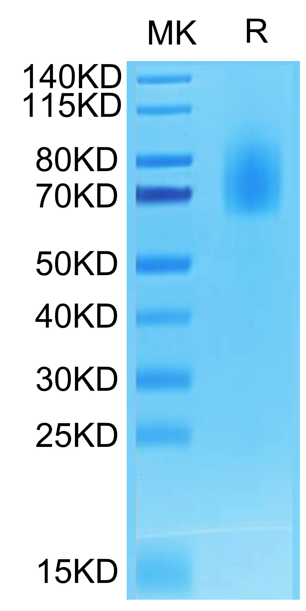 Biotinylated Recombinant Human TNFRSF8/CD30 Protein