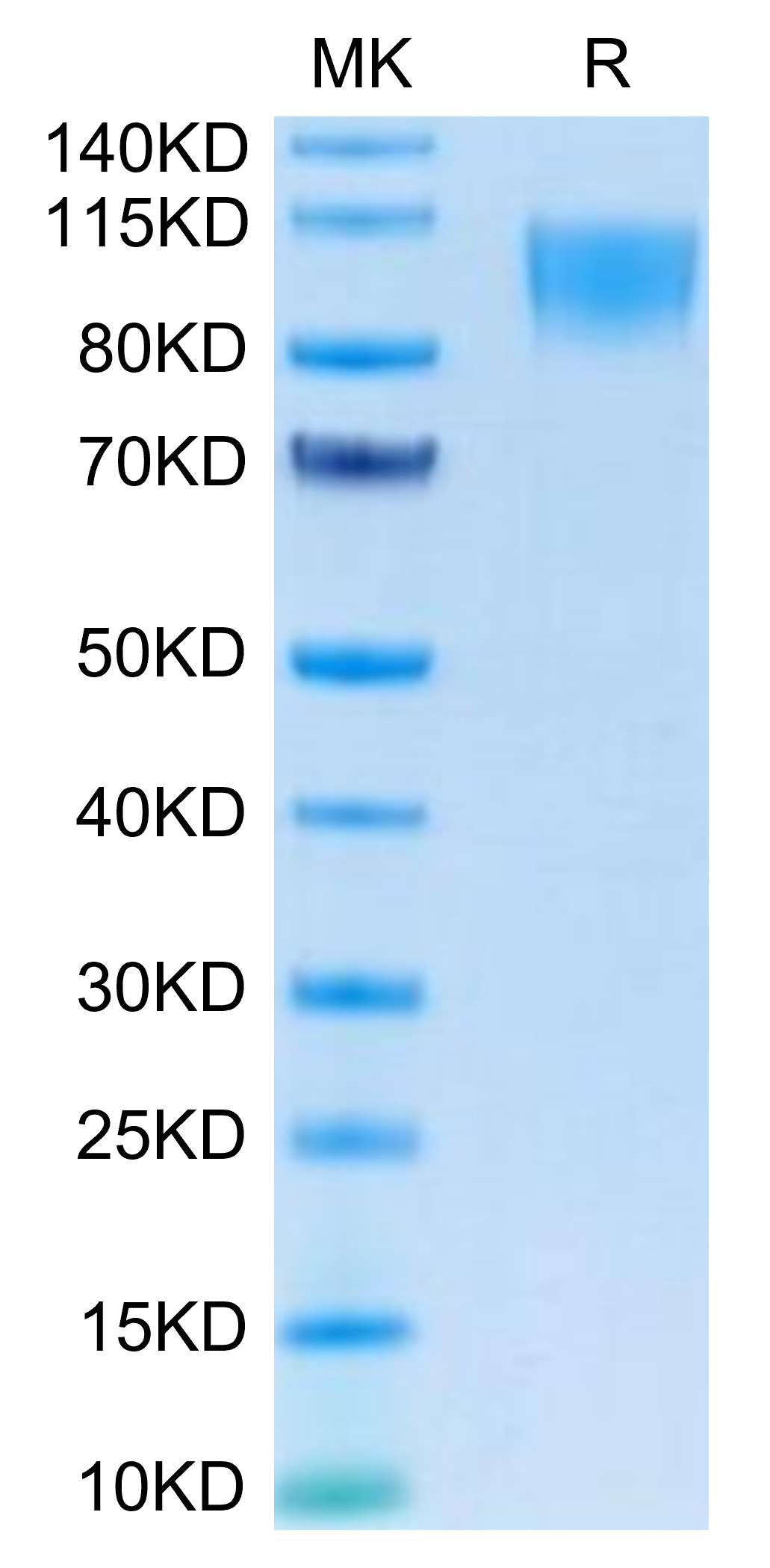 Recombinant Human TNFRSF8/CD30 Protein