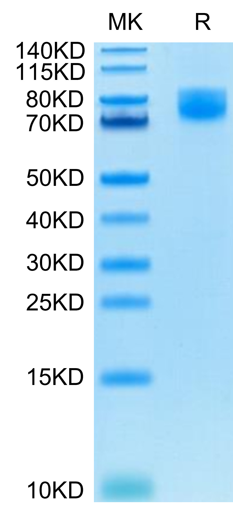 Recombinant Human B7-2/CD86 Protein