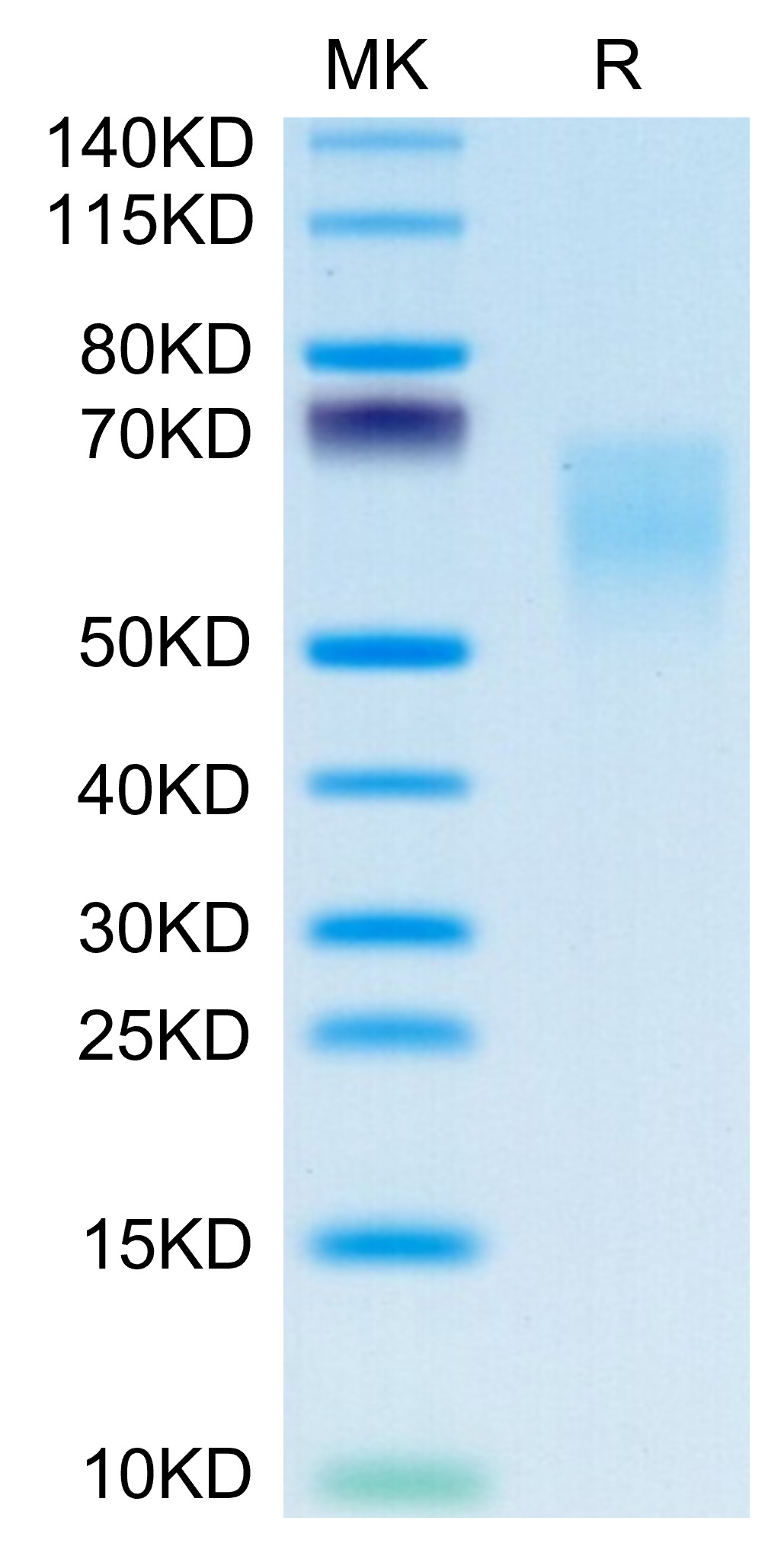 Recombinant Human B7-2/CD86 Protein