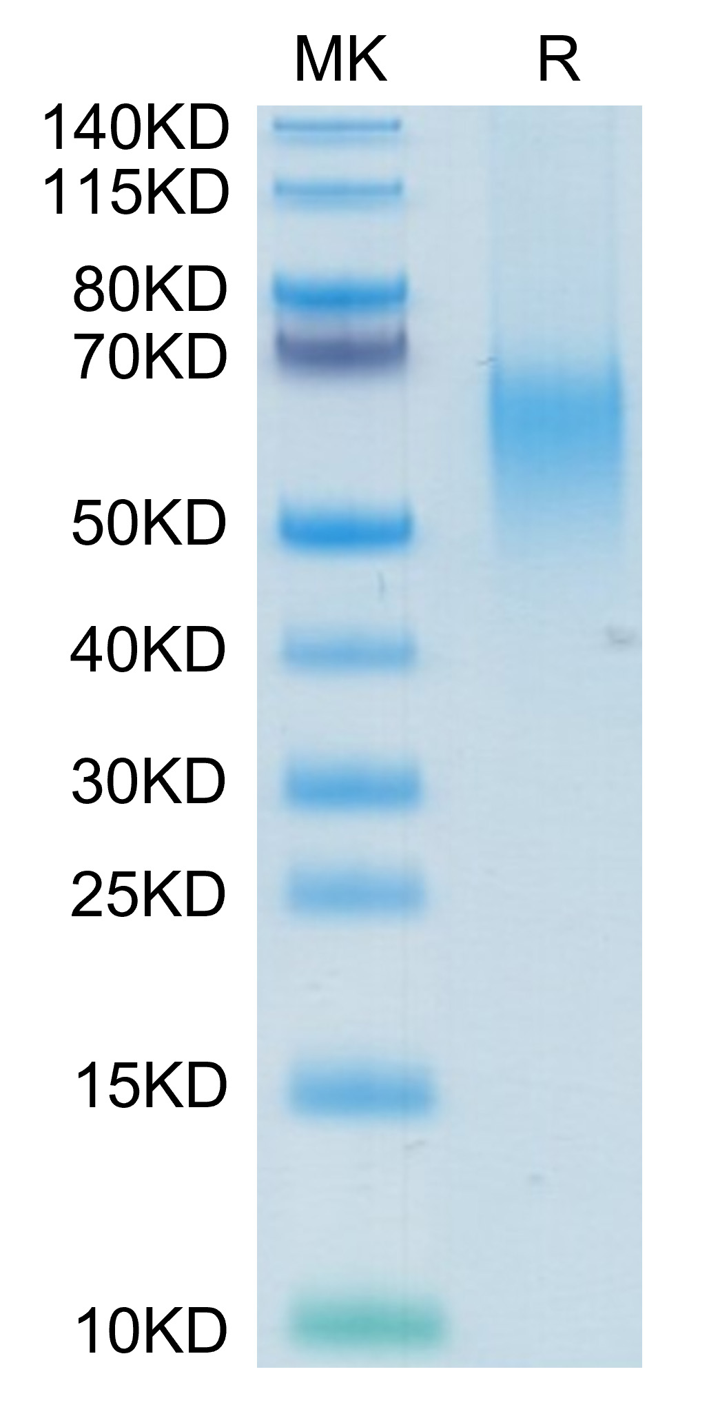 Recombinant Human B7-1/CD80 Protein