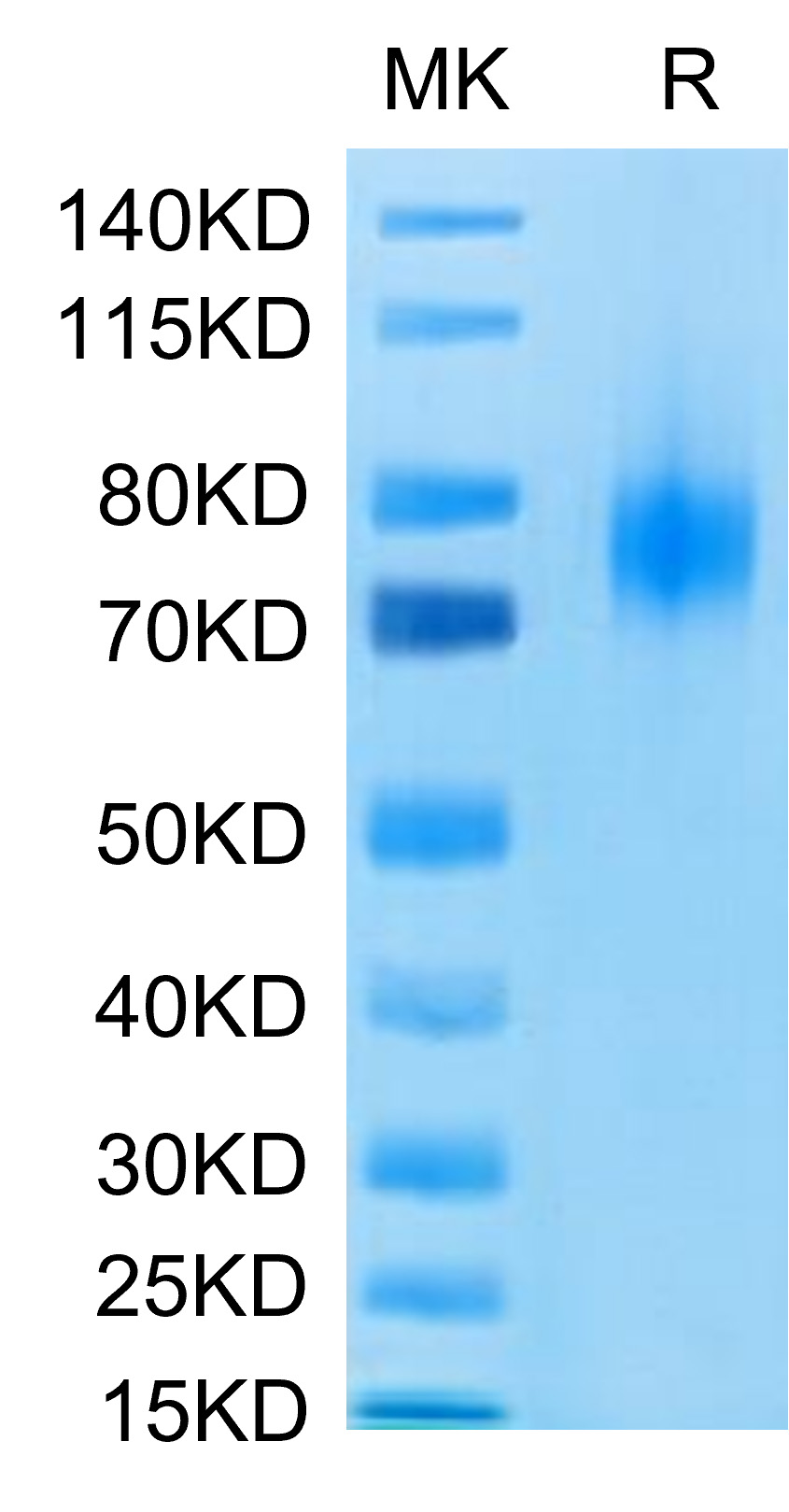 Recombinant Human B7-1/CD80 Protein