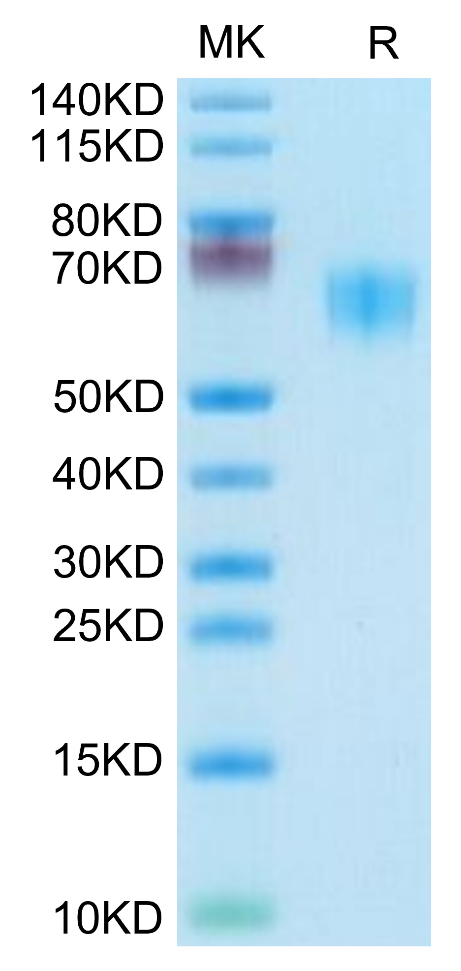 Recombinant Human/Cynomolgus/Rhesus macaque CD28 Protein