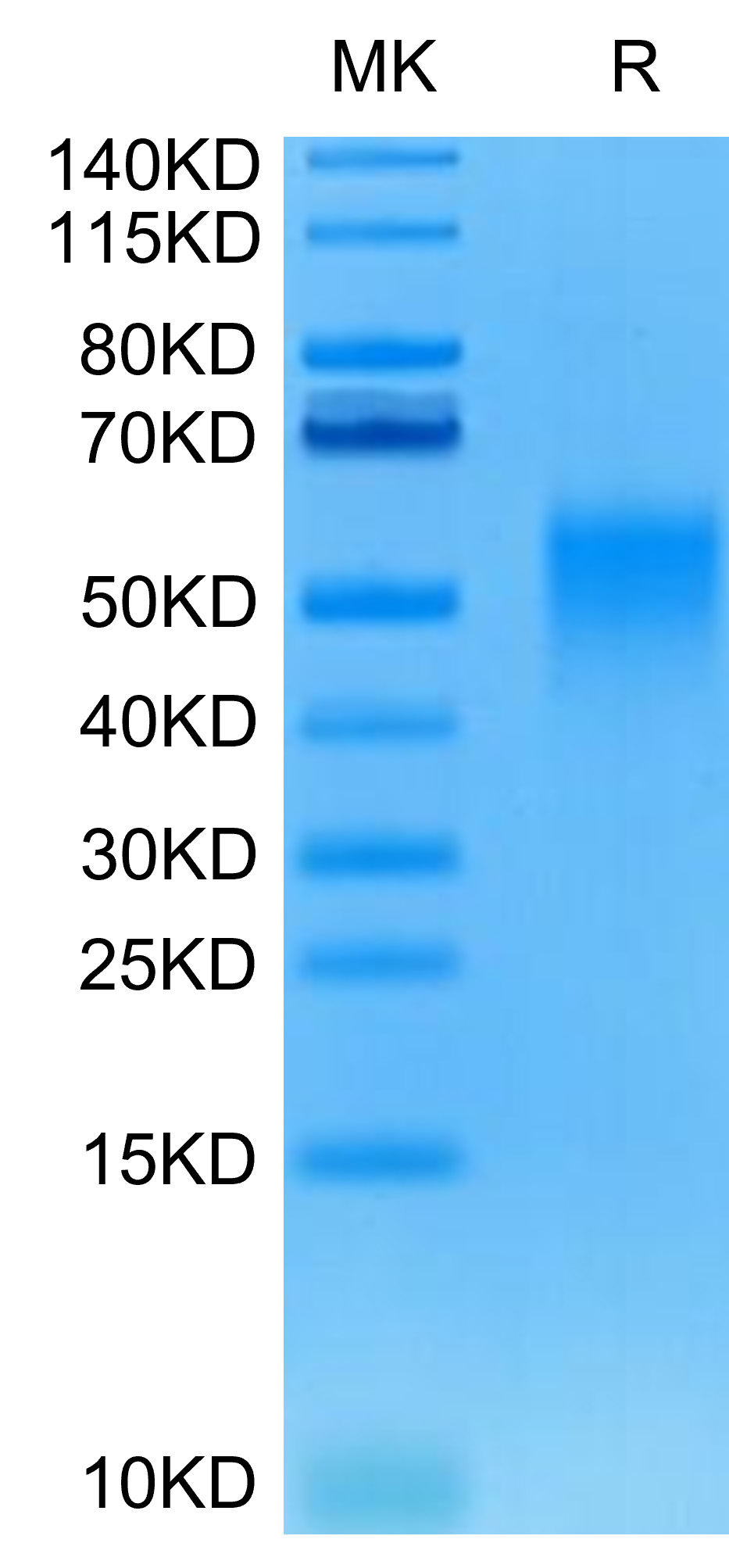 Recombinant Human/Cynomolgus/Rhesus macaque CD28 Protein