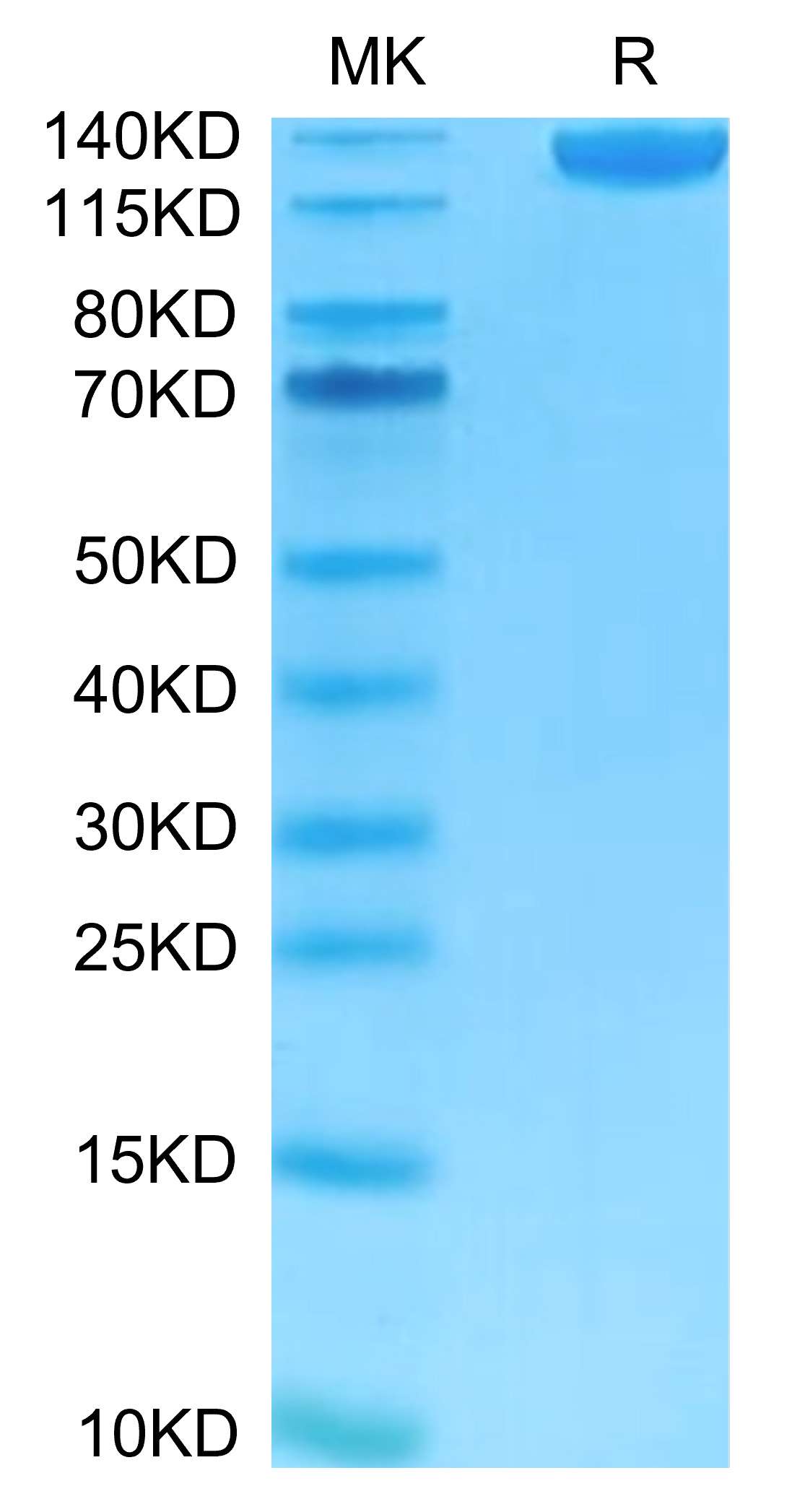 FITC-Labeled Recombinant Human Siglec-2/CD22 Protein