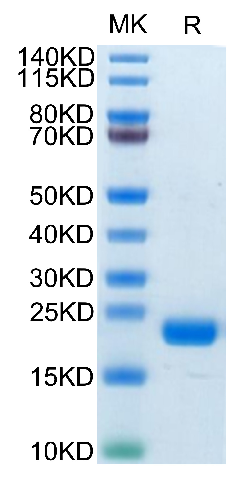 Biotinylated Recombinant Human MS4A1/CD20 Protein