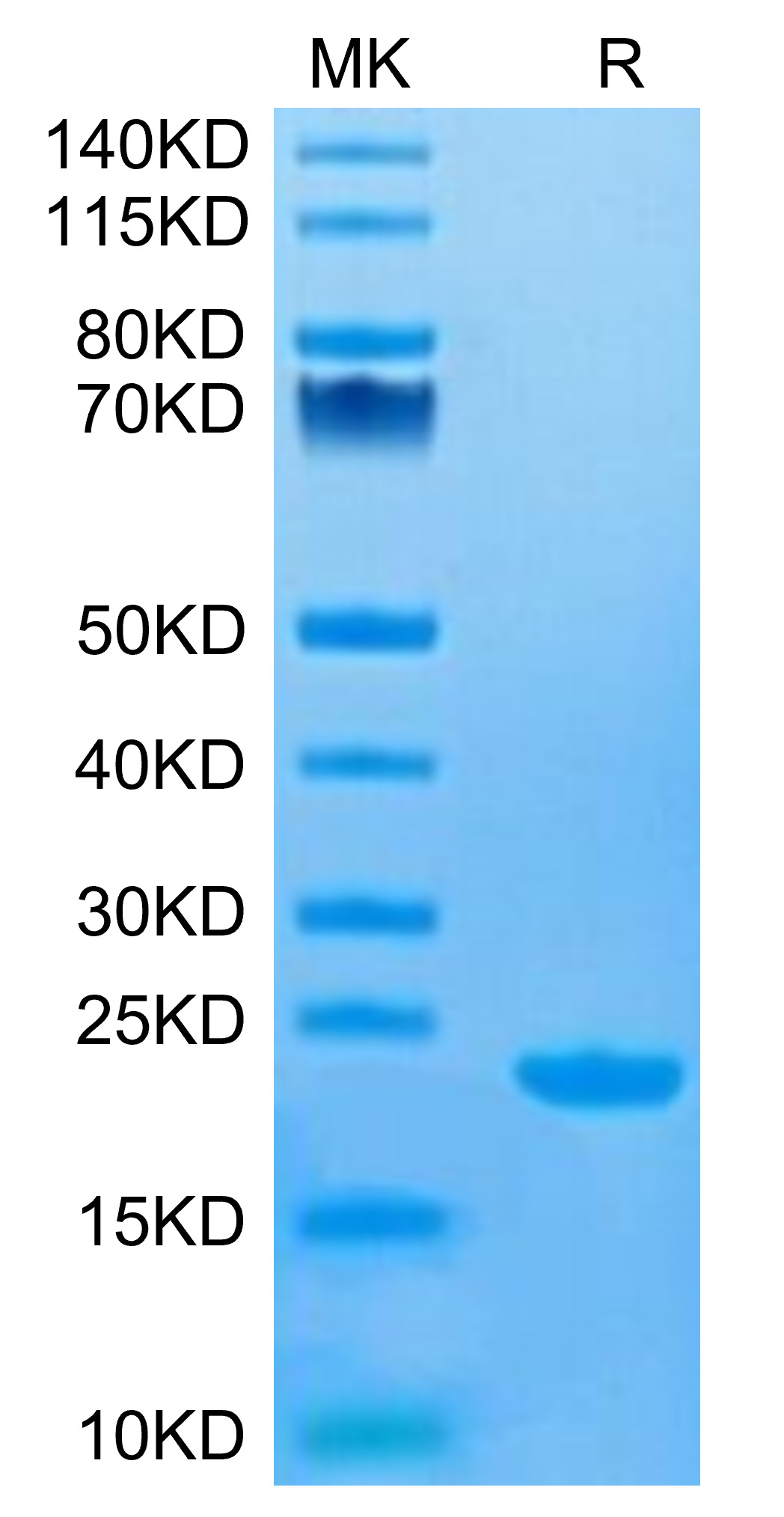 Recombinant Human MS4A1/CD20 Protein