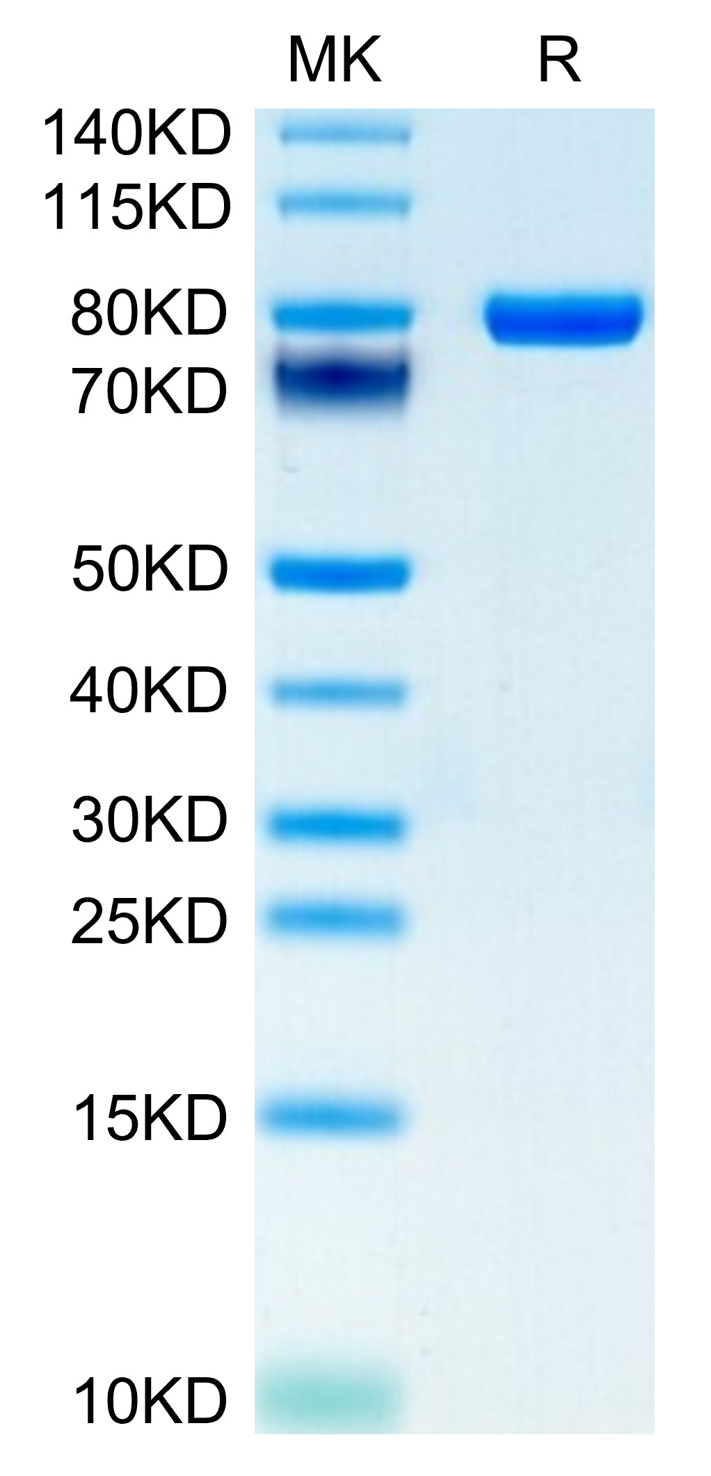 Recombinant Human CD5 Protein