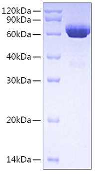 Recombinant Human Tissue-type plasminogen activator/TPA/PLAT Protein