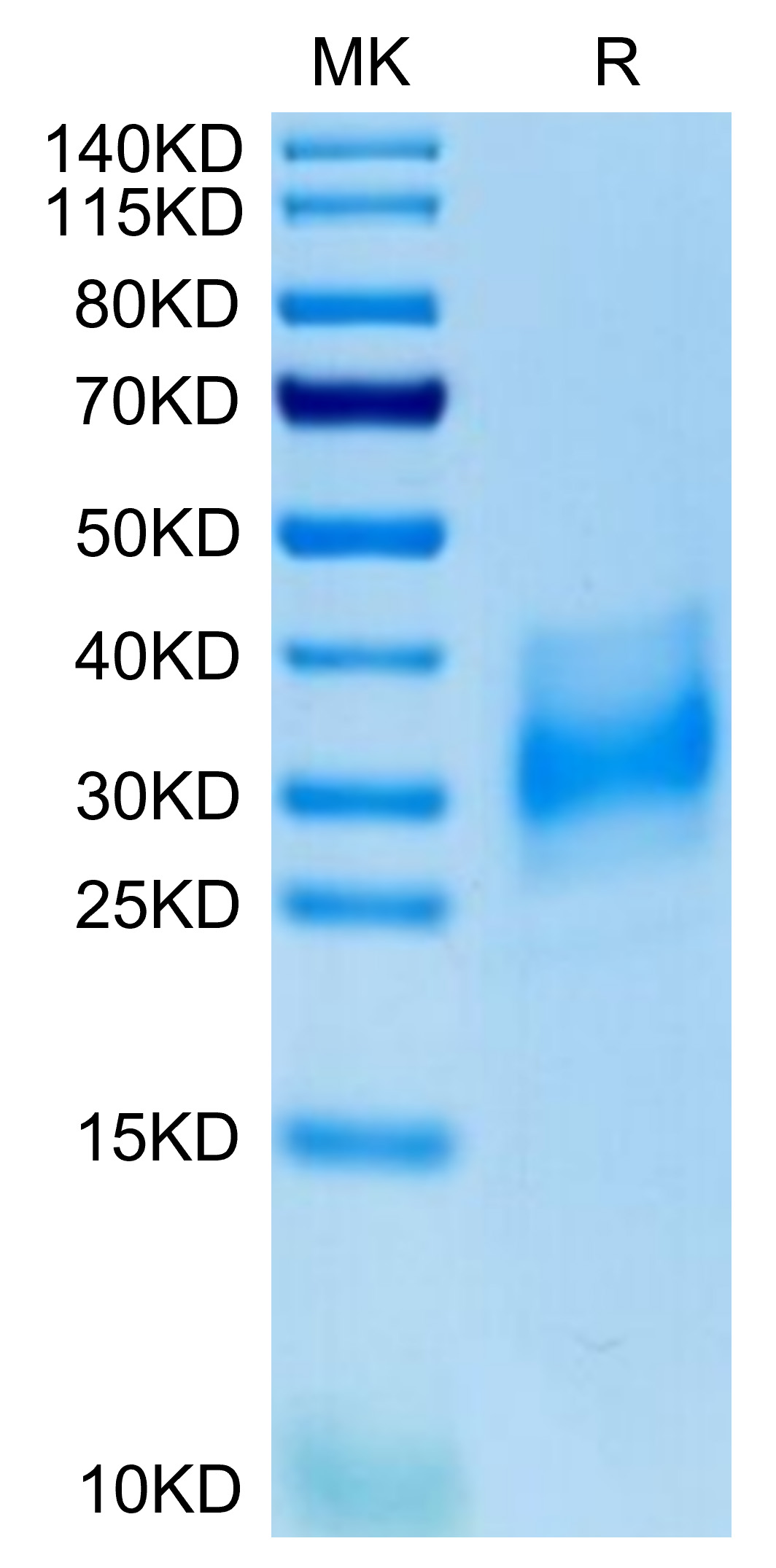 Recombinant Human Basigin EMMPRIN/CD147 Protein