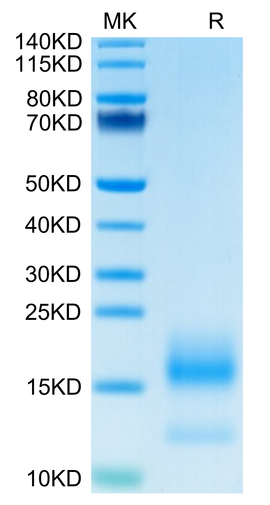 Recombinant Human TNFRSF17/BCMA/CD269 Protein