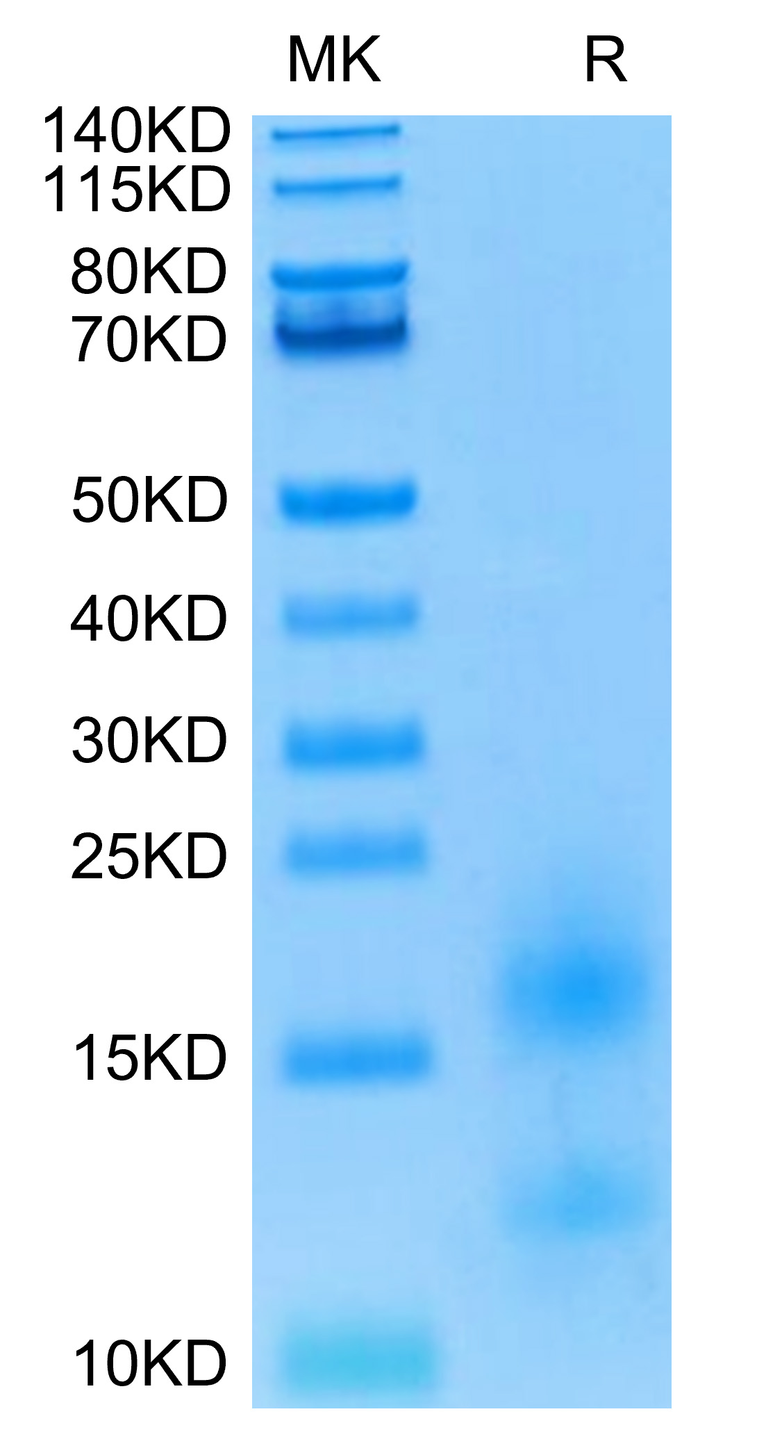 Biotinylated Recombinant Human TNFRSF17/BCMA/CD269 Protein