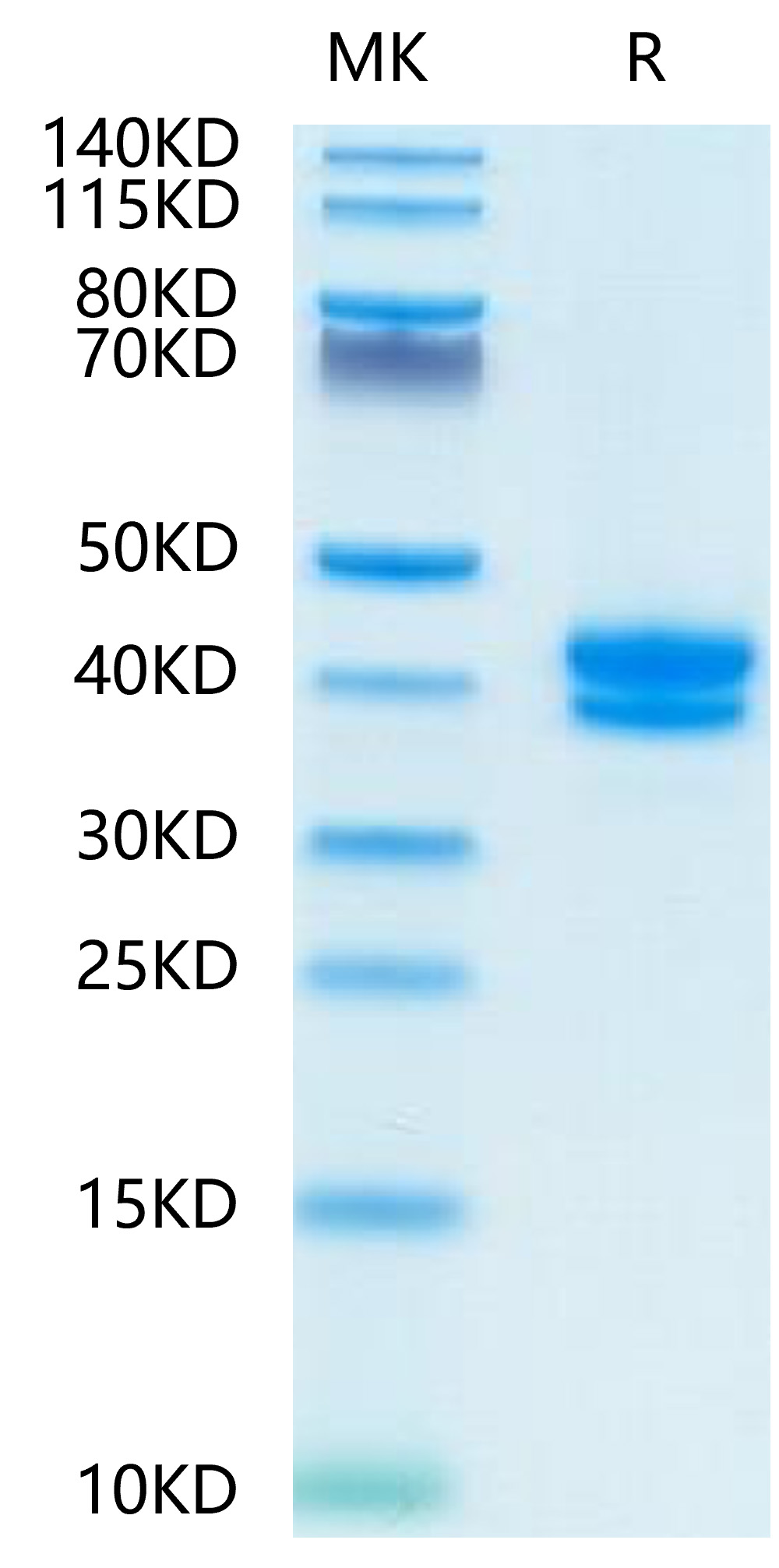 FITC-Compatible Recombinant Human TNFRSF17/BCMA/CD269 Protein