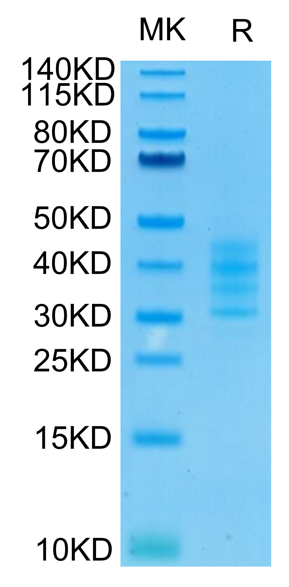 Recombinant HumanTNFRSF17/BCMA/CD269 Trimer Protein