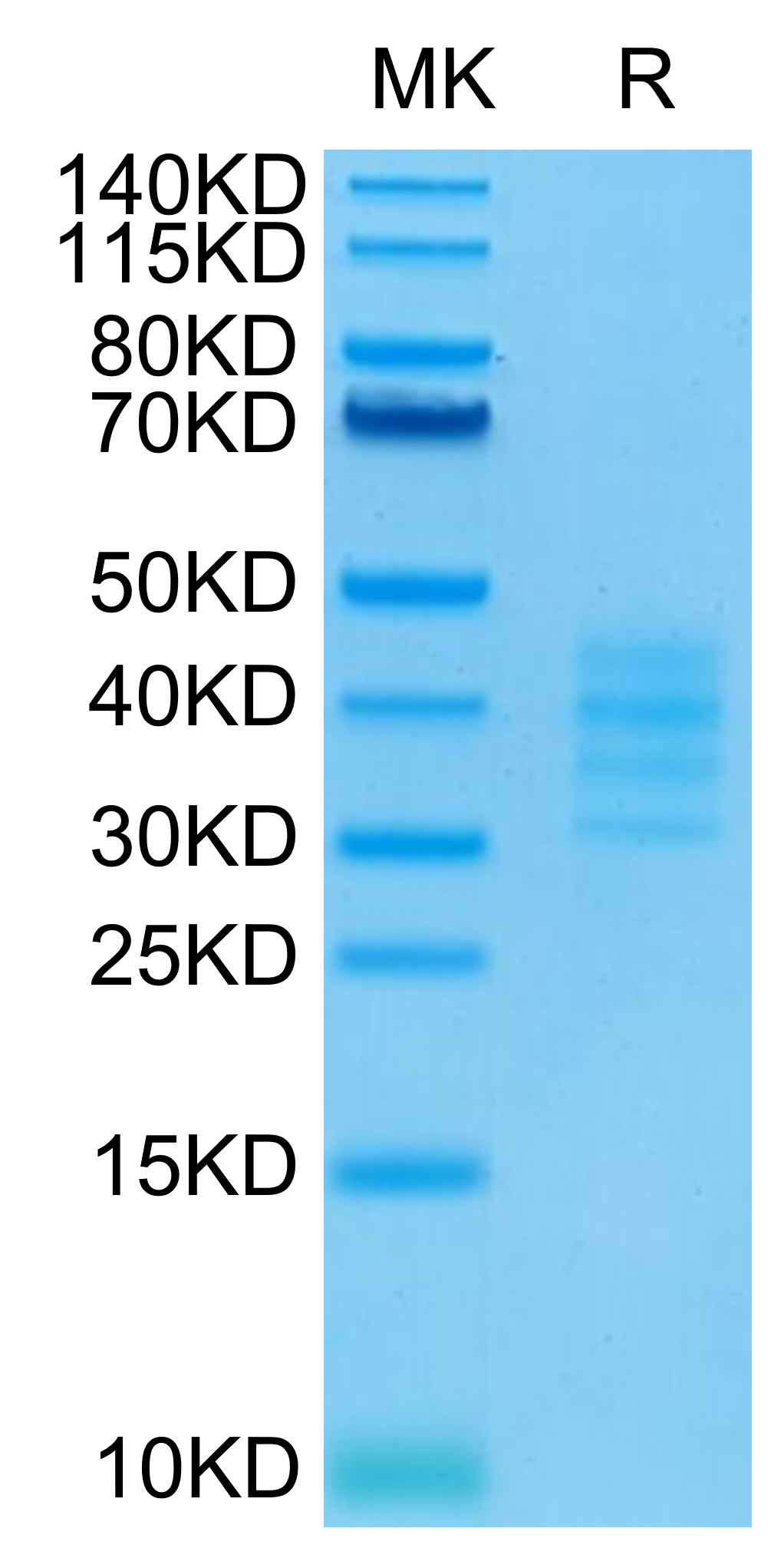 Biotinylated Recombinant Human TNFRSF17/BCMA/CD269 Trimer Protein