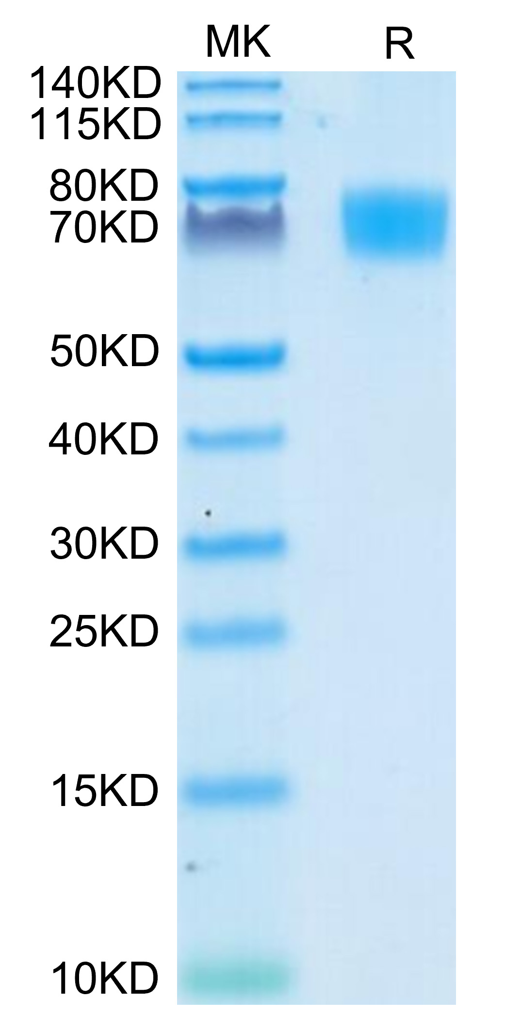 Recombinant Human ALCAM/CD166 Protein