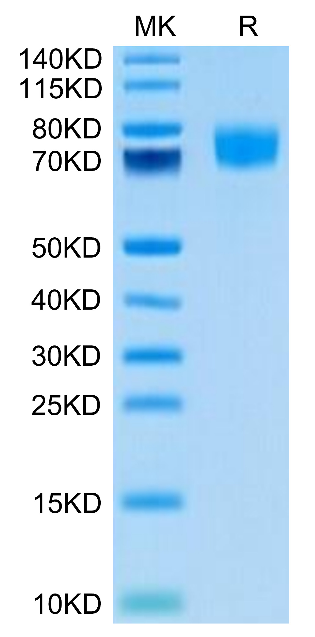 Biotinylated Recombinant Human ALCAM/CD166 Protein (Primary Amine Labeling)