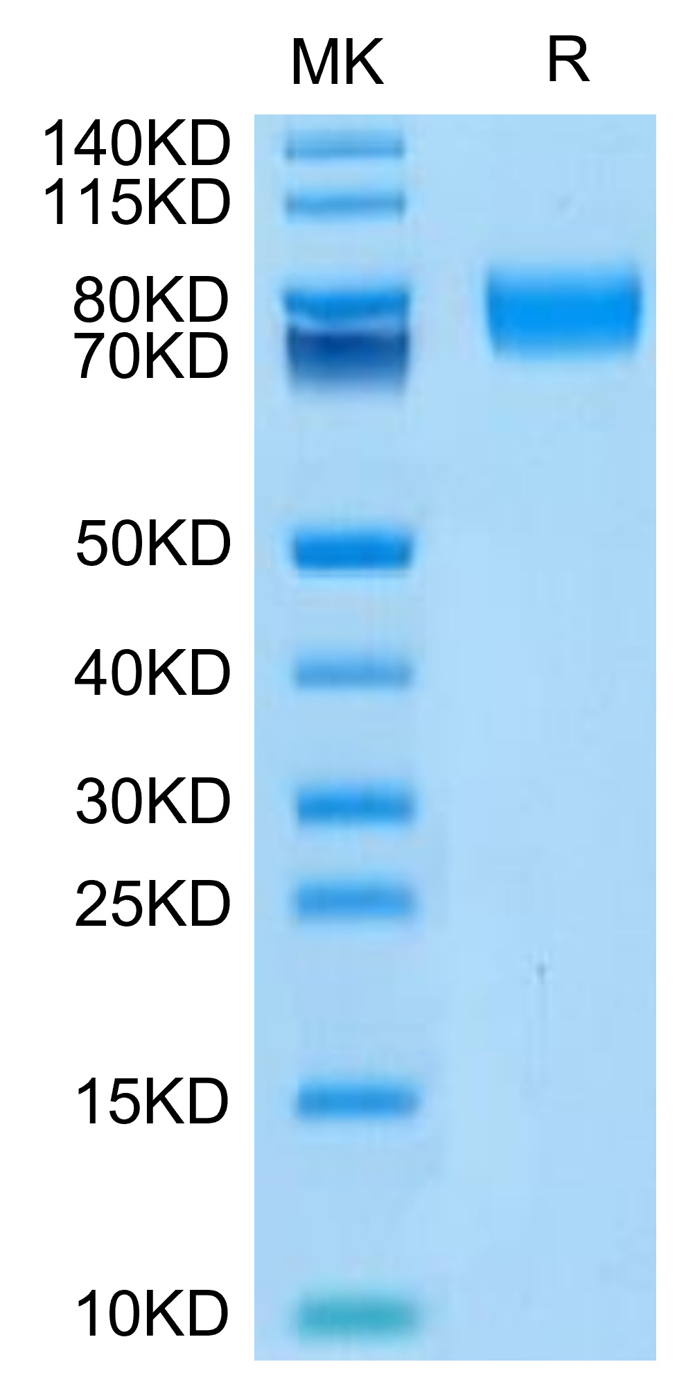 Biotinylated Recombinant Human ALCAM/CD166 Protein