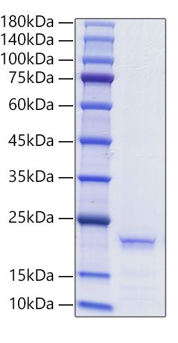 Recombinant Human Ferritin heavy chain/FTH1 Protein