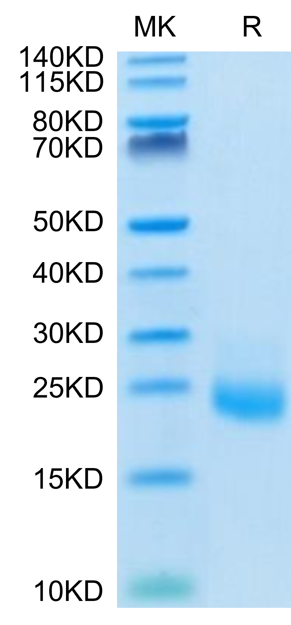 Recombinant Human IL-31 Protein