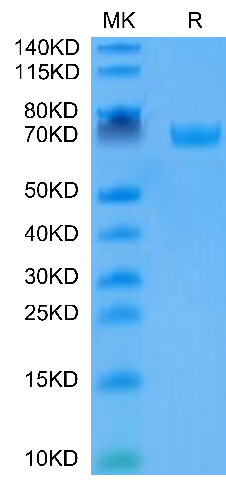 Recombinant Human B7-H3/CD276 Protein