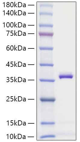 Recombinant Mouse Apolipoprotein E/APOE Protein