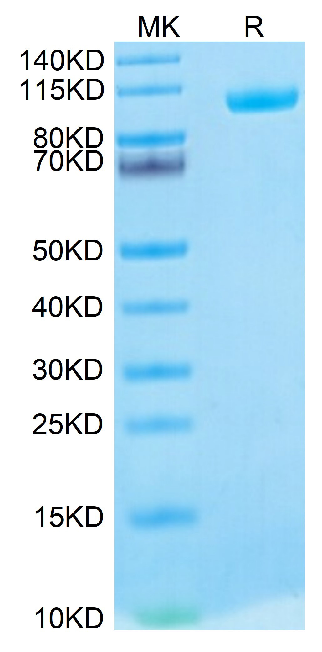 Biotinylated Recombinant Human MMP-9 Protein