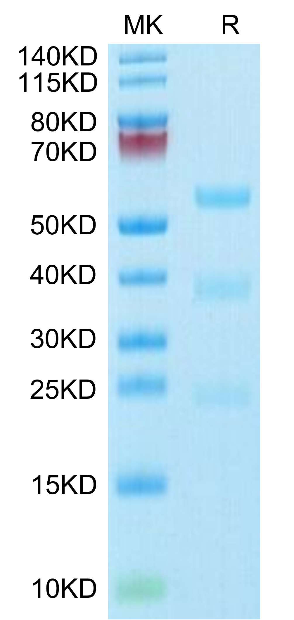 Biotinylated Recombinant Human uPA/PLAU Protein