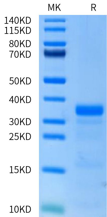 Recombinant Human uPA/PLAU Protein