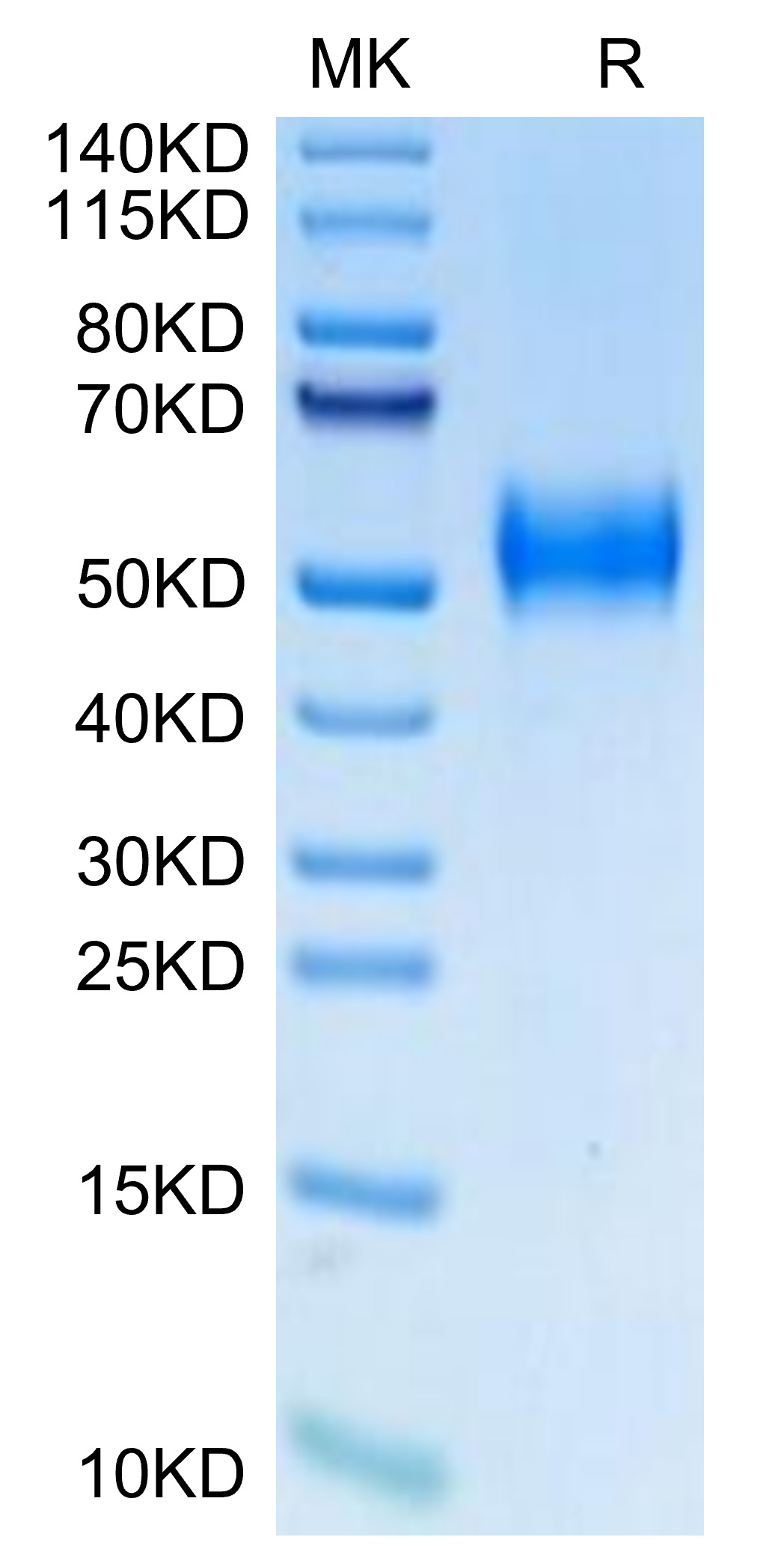 Biotinylated Recombinant Human uPAR/PLAUR/CD87 Protein