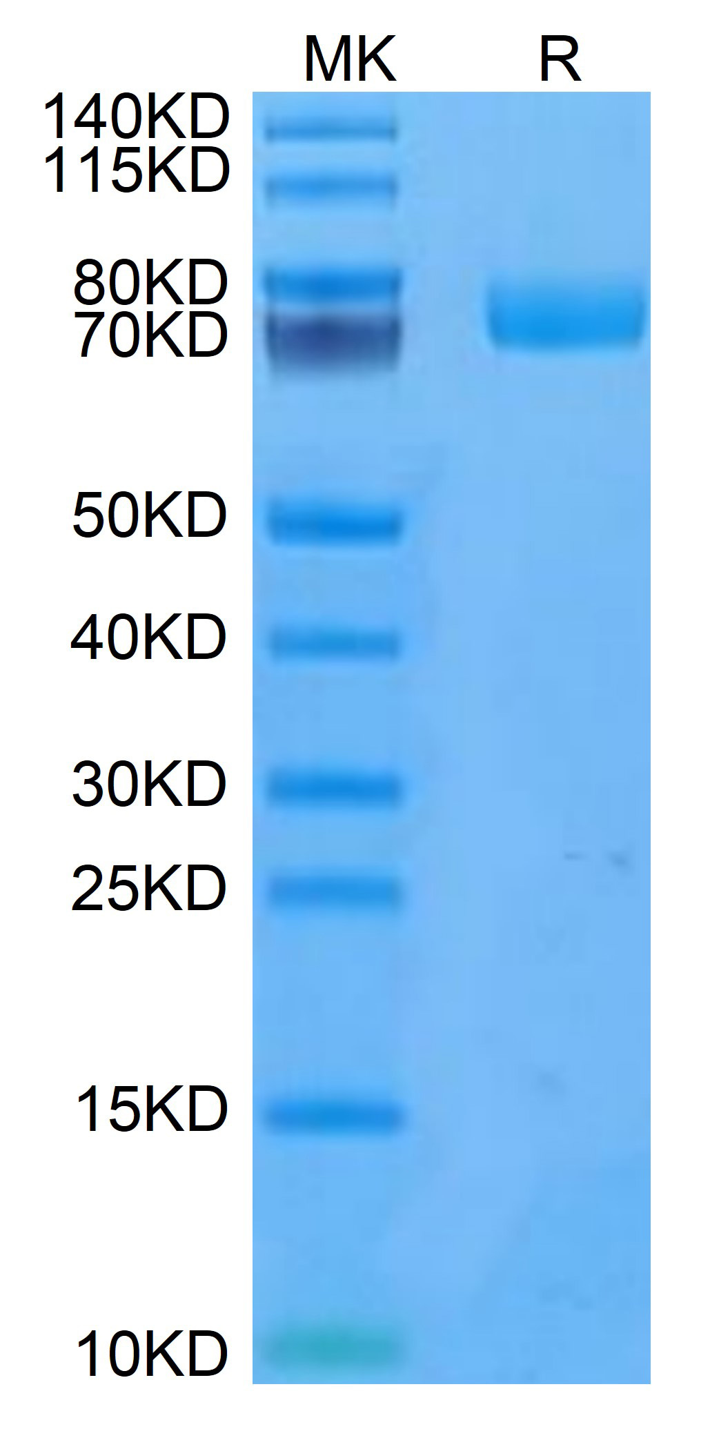 Recombinant Human uPAR/PLAUR/CD87 Protein