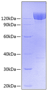 Phospho-PDGFR alpha-Y849 Rabbit pAb