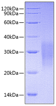 Recombinant Mouse TNFRSF6/FAS/CD95 Protein