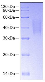 Recombinant Human TNFRSF10C/DcR1/TRAIL-R3/CD263 Protein