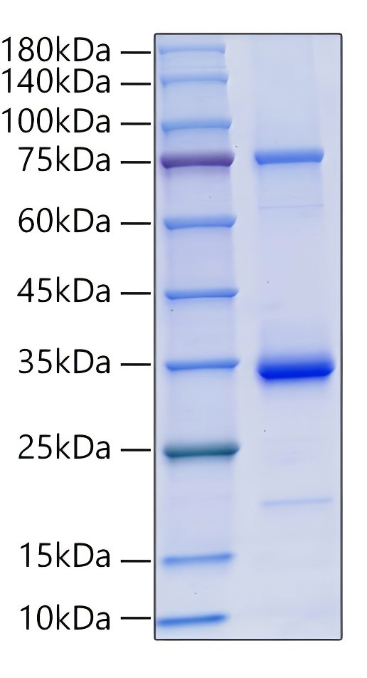 Recombinant Human MMP-2 Protein