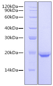 Recombinant Human IL-17F Protein