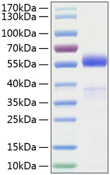 Recombinant Human Frizzled-1/FZD1 Protein