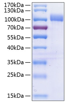 Recombinant Human VCAM-1/CD106 Protein