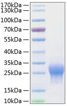 Recombinant Human ALK-1/ACVRL1 Protein