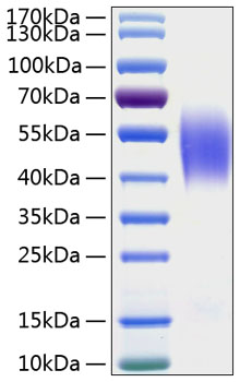 Recombinant Human CEACAM6/CD66c Protein